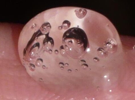 Pulsero -Gel use of Algirdas from Tallinn